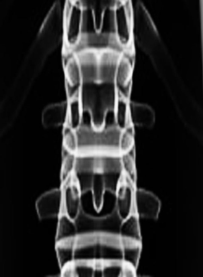 Three Rooker ربطات عنق ثلاثية من روكر بتصميم هيكل عظمي للرجال، ربطة عنق طبية للرجال، ربطة عنق على شكل عمود فقري - Image 3